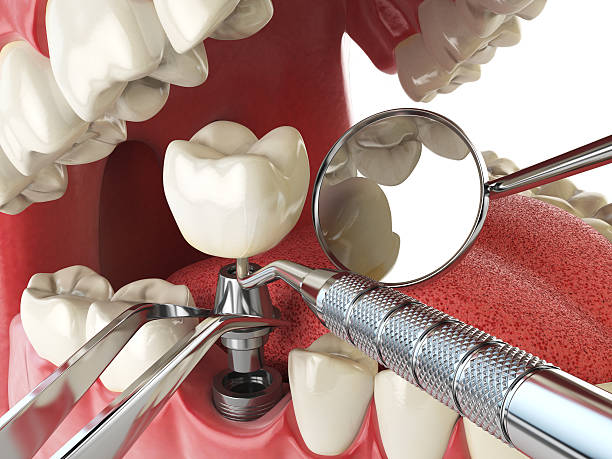 Best Dentist for Severe Toothache  in Berwyn Heights, MD