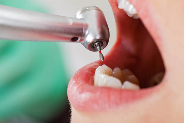 Best Dentist for Tooth Abscess  in Berwyn Heights, MD